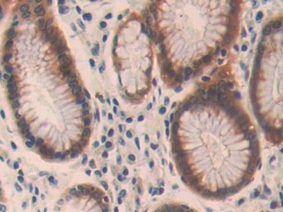 Polyclonal Antibody to Oncoprotein Induced Transcript 3 (OIT3)