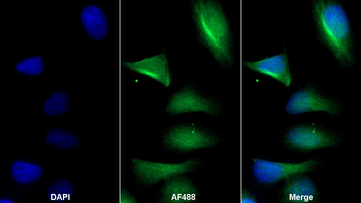 Polyclonal Antibody to Cluster Of differentiation 299 (CD299)