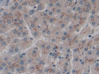 Polyclonal Antibody to Cluster Of differentiation 301 (CD301)