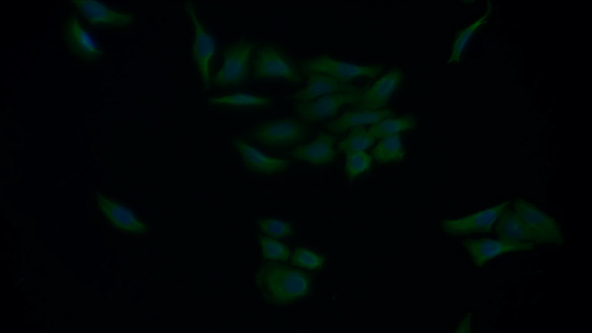 Polyclonal Antibody to Caspase 4 (CASP4)