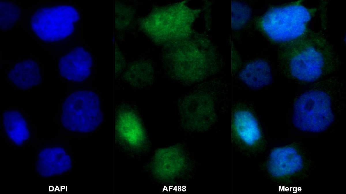 Polyclonal Antibody to Protein Inhibitor Of Activated STAT 1 (PIAS1)