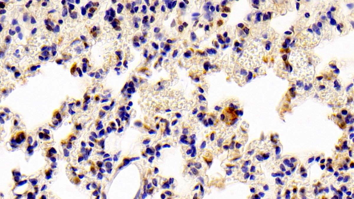 Polyclonal Antibody to Signal Transducer And Activator Of Transcription 6 (STAT6)