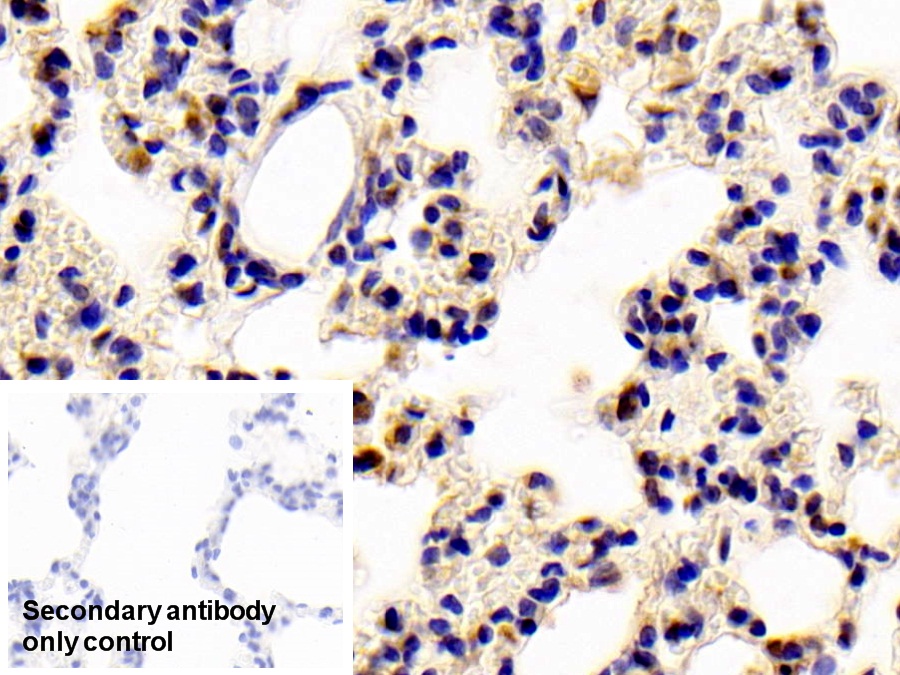 Polyclonal Antibody to Signal Transducer And Activator Of Transcription 6 (STAT6)