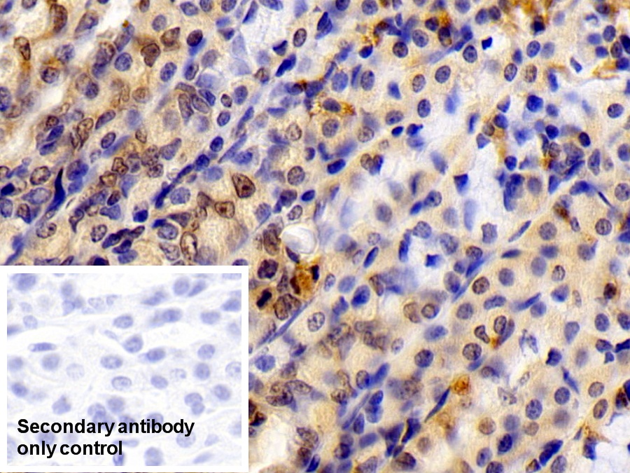 Polyclonal Antibody to Signal Transducer And Activator Of Transcription 6 (STAT6)