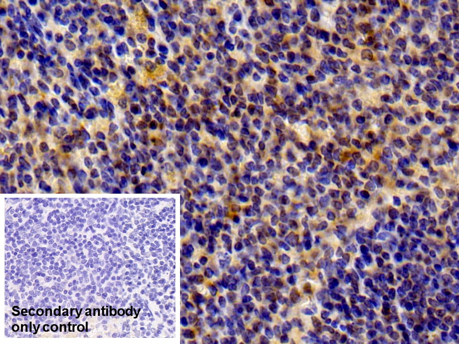 Polyclonal Antibody to Signal Transducer And Activator Of Transcription 6 (STAT6)