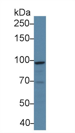 Polyclonal Antibody to Signal Transducer And Activator Of Transcription 5A (STAT5A)