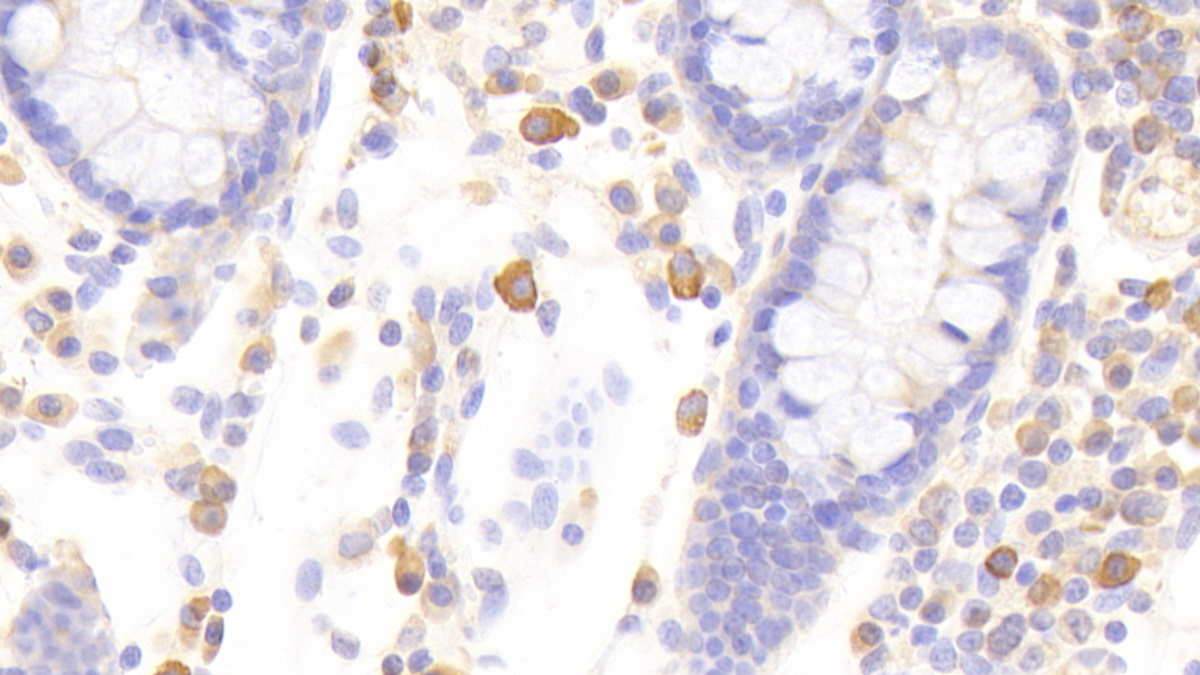 Polyclonal Antibody to Signal Transducer And Activator Of Transcription 1 (STAT1)