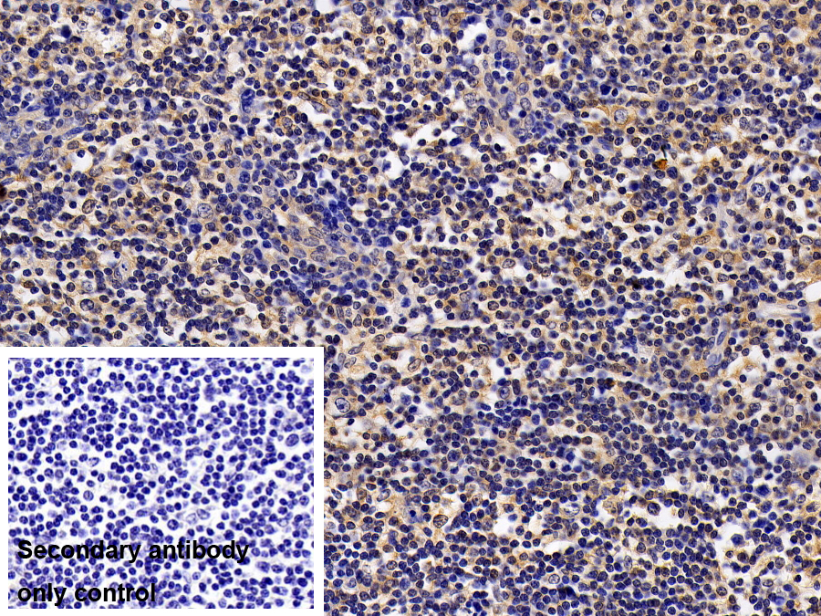 Polyclonal Antibody to Signal Transducer And Activator Of Transcription 1 (STAT1)