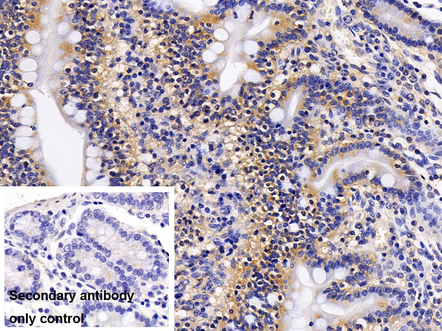 Polyclonal Antibody to Signal Transducer And Activator Of Transcription 1 (STAT1)