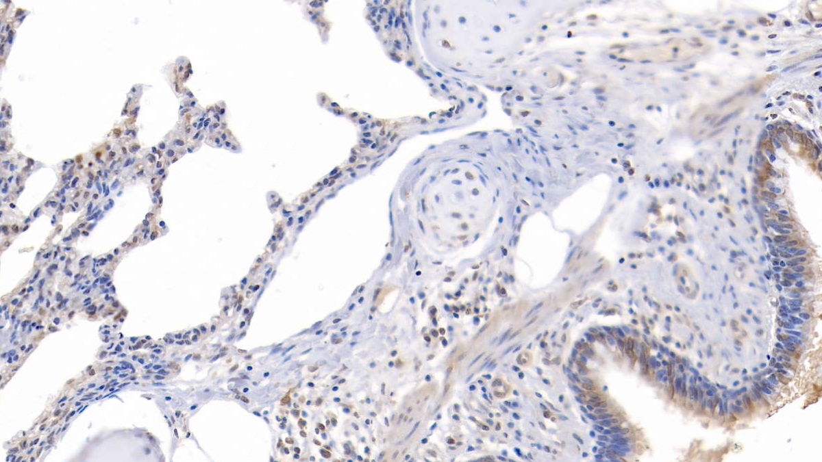 Polyclonal Antibody to Signal Transducer And Activator Of Transcription 1 (STAT1)