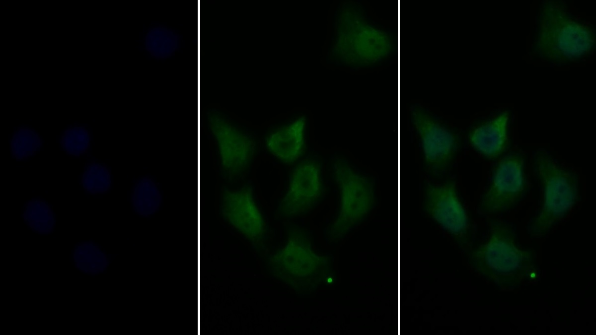 Polyclonal Antibody to Signal Transducer And Activator Of Transcription 1 (STAT1)