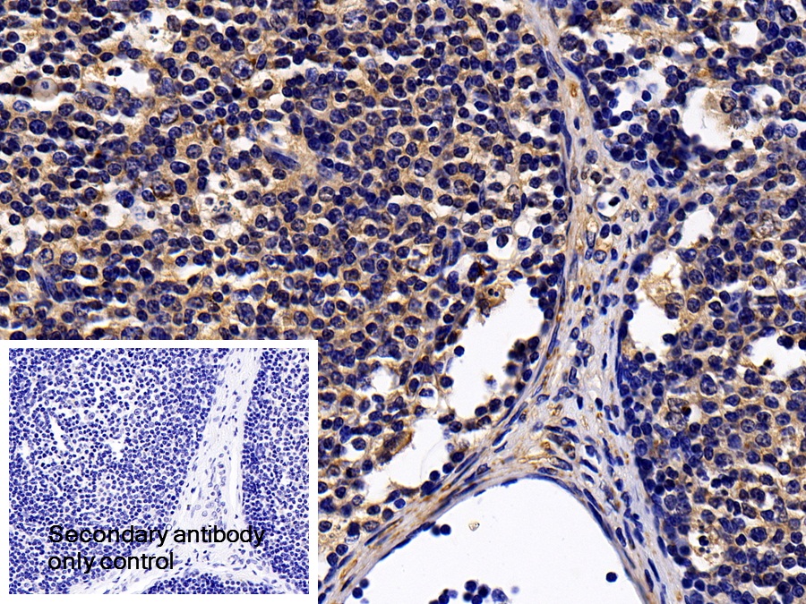 Polyclonal Antibody to Signal Transducer And Activator Of Transcription 1 (STAT1)