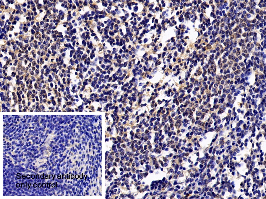 Polyclonal Antibody to Signal Transducer And Activator Of Transcription 1 (STAT1)