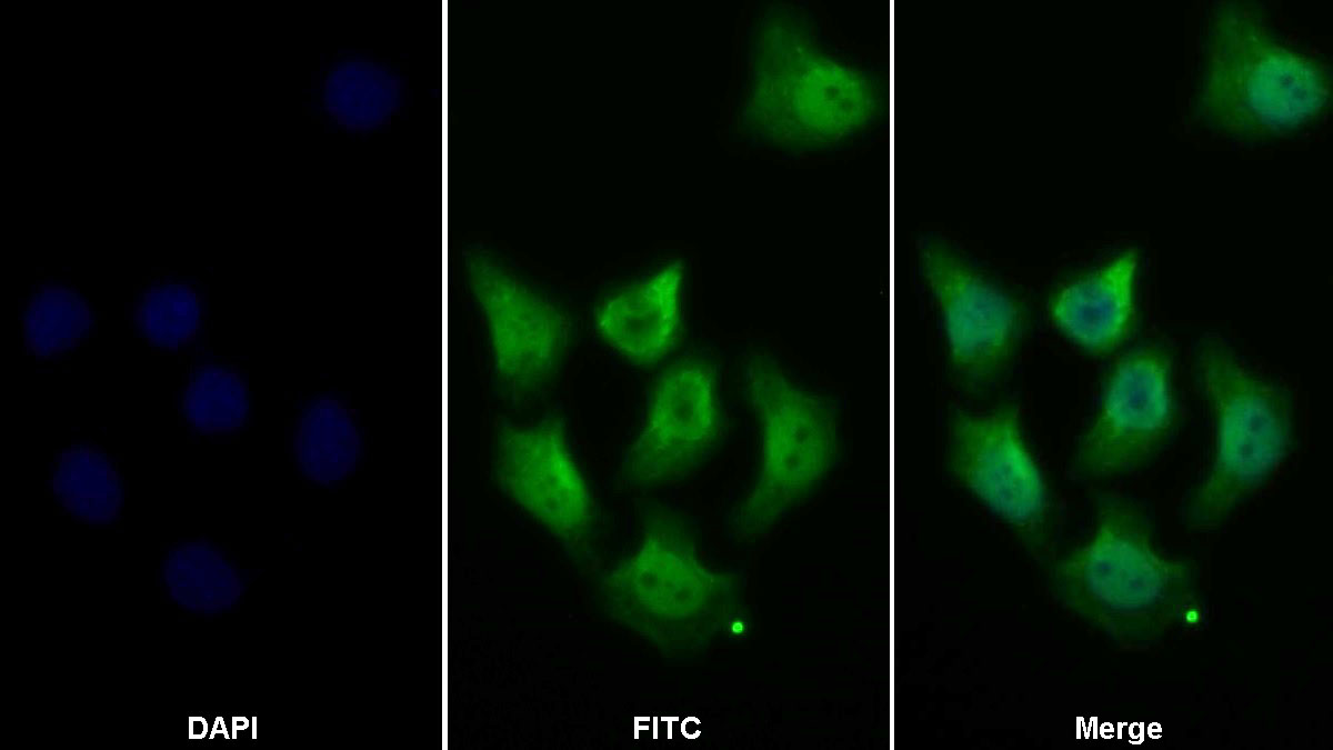 Polyclonal Antibody to Signal Transducer And Activator Of Transcription 1 (STAT1)