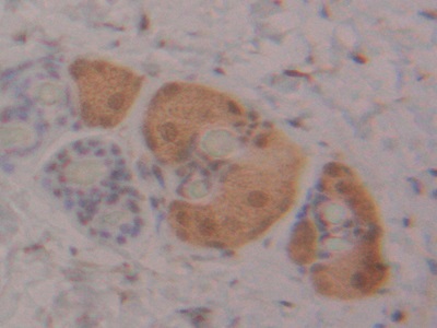 Polyclonal Antibody to Signal Transducer And Activator Of Transcription 1 (STAT1)