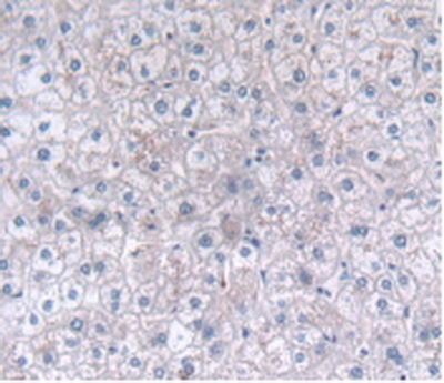 Polyclonal Antibody to C-Type Lectin Domain Family 4, Member C (CLEC4C)