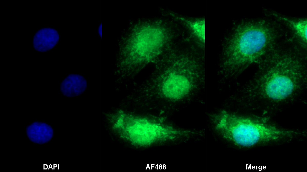 Polyclonal Antibody to Signal Transducer And Activator Of Transcription 3 (STAT3)