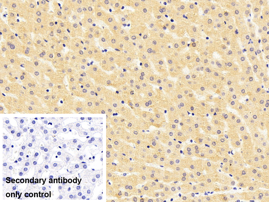 Polyclonal Antibody to Signal Transducer And Activator Of Transcription 3 (STAT3)