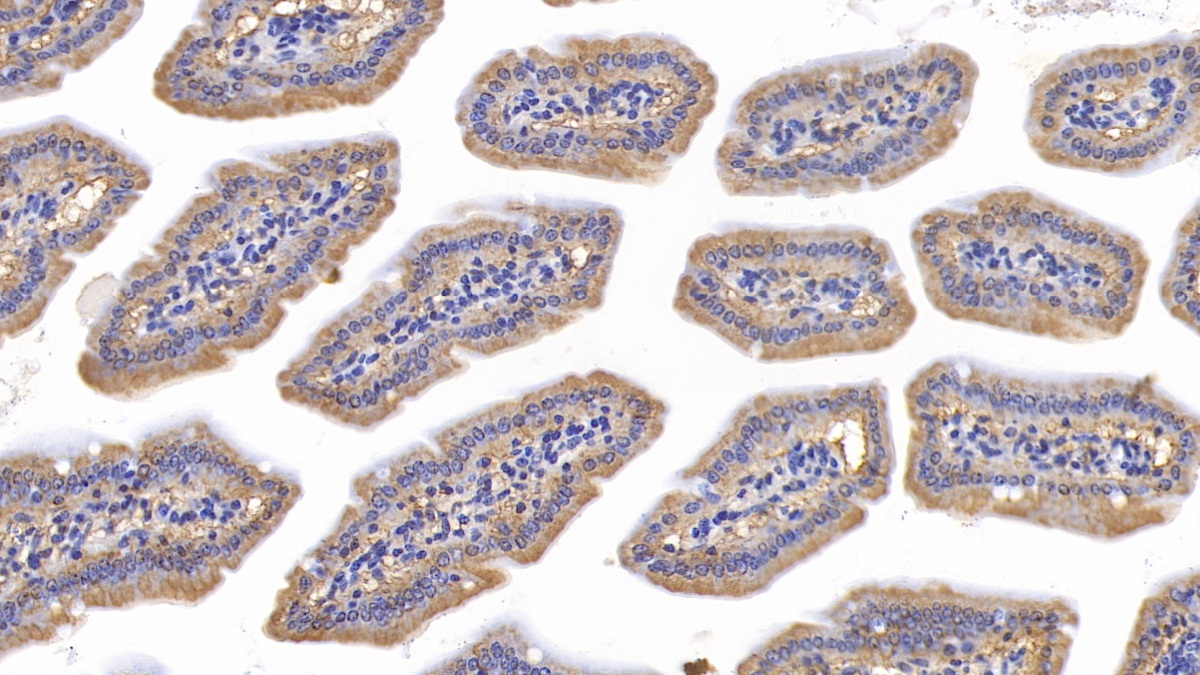 Polyclonal Antibody to Signal Transducer And Activator Of Transcription 3 (STAT3)