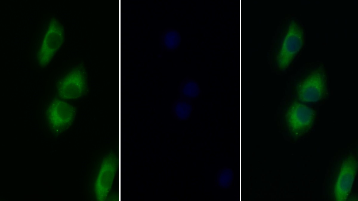 Polyclonal Antibody to Signal Transducer And Activator Of Transcription 3 (STAT3)