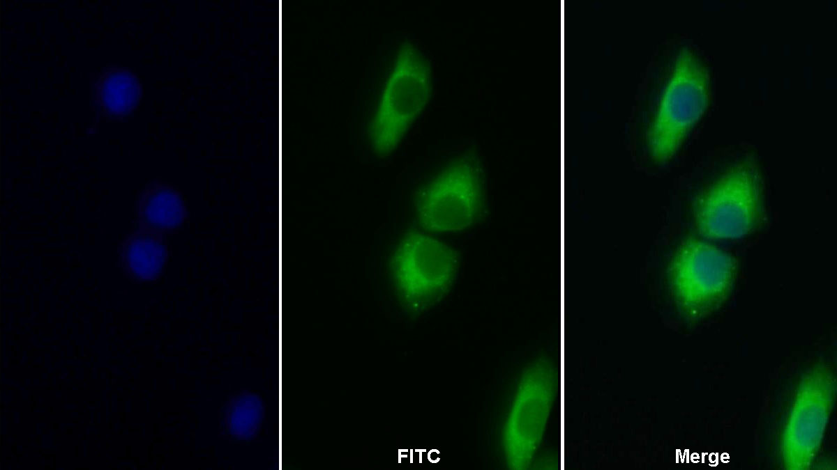 Polyclonal Antibody to Signal Transducer And Activator Of Transcription 3 (STAT3)