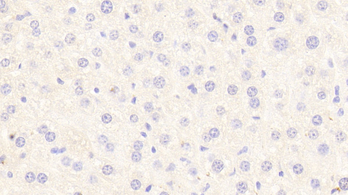 Polyclonal Antibody to Signal Transducer And Activator Of Transcription 3 (STAT3)