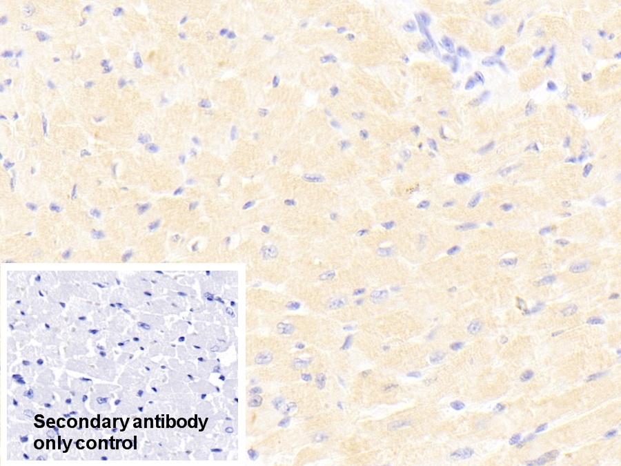 Polyclonal Antibody to Signal Transducer And Activator Of Transcription 3 (STAT3)