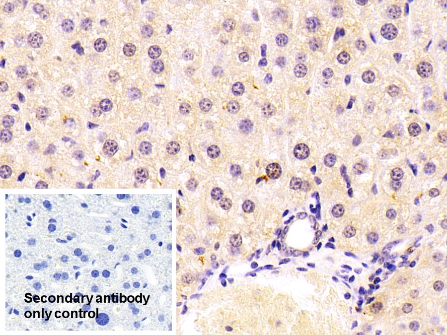 Polyclonal Antibody to Signal Transducer And Activator Of Transcription 3 (STAT3)