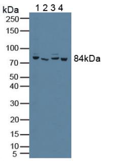 Polyclonal Antibody to Phosphofructokinase, Platelet (PFKP)