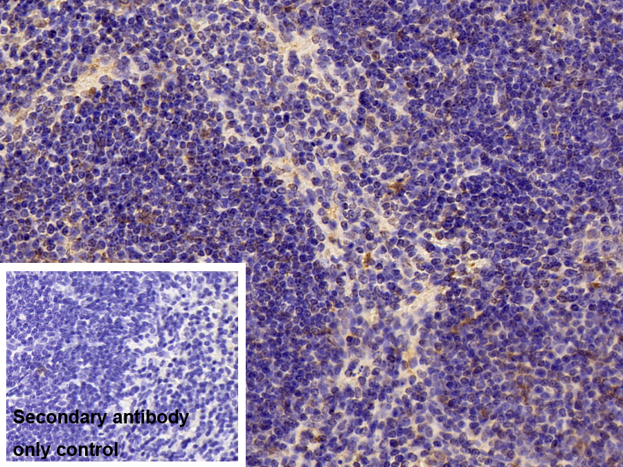 Polyclonal Antibody to Phosphofructokinase, Platelet (PFKP)