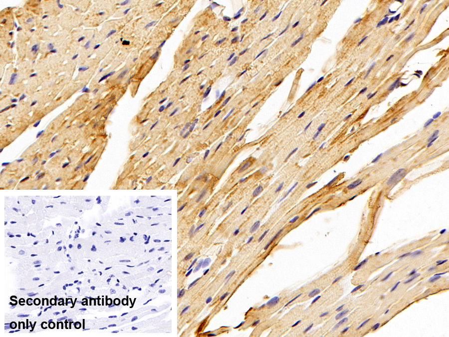 Polyclonal Antibody to Phosphofructokinase, Platelet (PFKP)