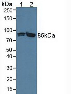 Polyclonal Antibody to Phosphofructokinase, Platelet (PFKP)