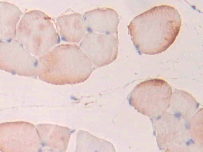 Polyclonal Antibody to Phosphofructokinase, Platelet (PFKP)