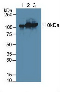 Polyclonal Antibody to Hexokinase 3, White Cell (HK3)