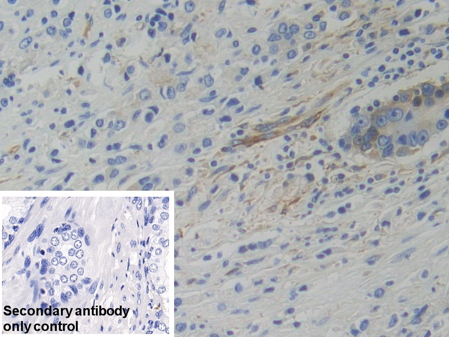 Polyclonal Antibody to Tryptophanyl tRNA Synthetase (WARS)