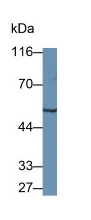 Polyclonal Antibody to Tryptophanyl tRNA Synthetase (WARS)