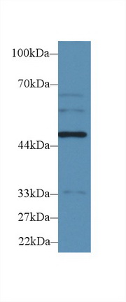 Polyclonal Antibody to Tryptophanyl tRNA Synthetase (WARS)