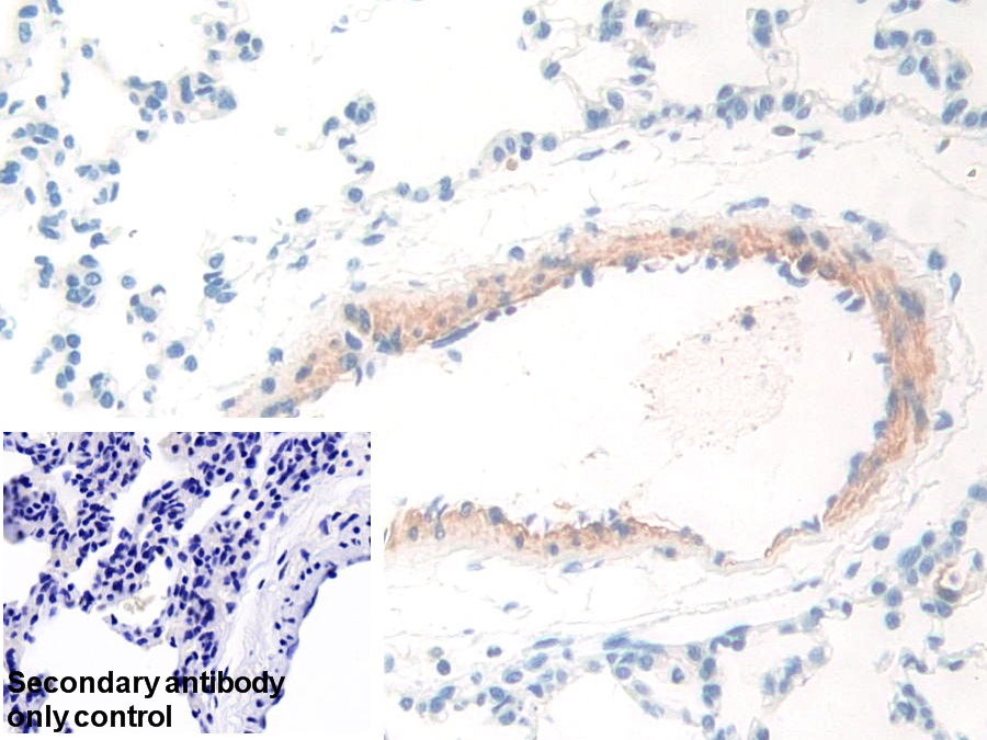 Polyclonal Antibody to Tryptophanyl tRNA Synthetase (WARS)