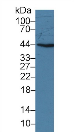 Polyclonal Antibody to Tumor Necrosis Factor Ligand Superfamily, Member 13 (TNFSF13)