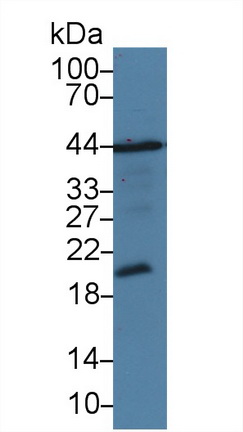 Polyclonal Antibody to Tumor Necrosis Factor Ligand Superfamily, Member 13 (TNFSF13)