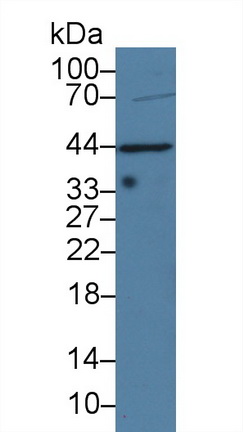 Polyclonal Antibody to Tumor Necrosis Factor Ligand Superfamily, Member 13 (TNFSF13)