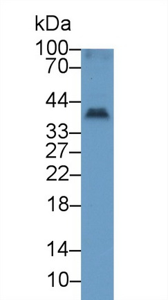 Polyclonal Antibody to Tumor Necrosis Factor Ligand Superfamily, Member 13 (TNFSF13)