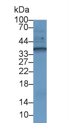 Polyclonal Antibody to Tumor Necrosis Factor Ligand Superfamily, Member 13 (TNFSF13)