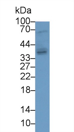 Polyclonal Antibody to Tumor Necrosis Factor Ligand Superfamily, Member 13 (TNFSF13)