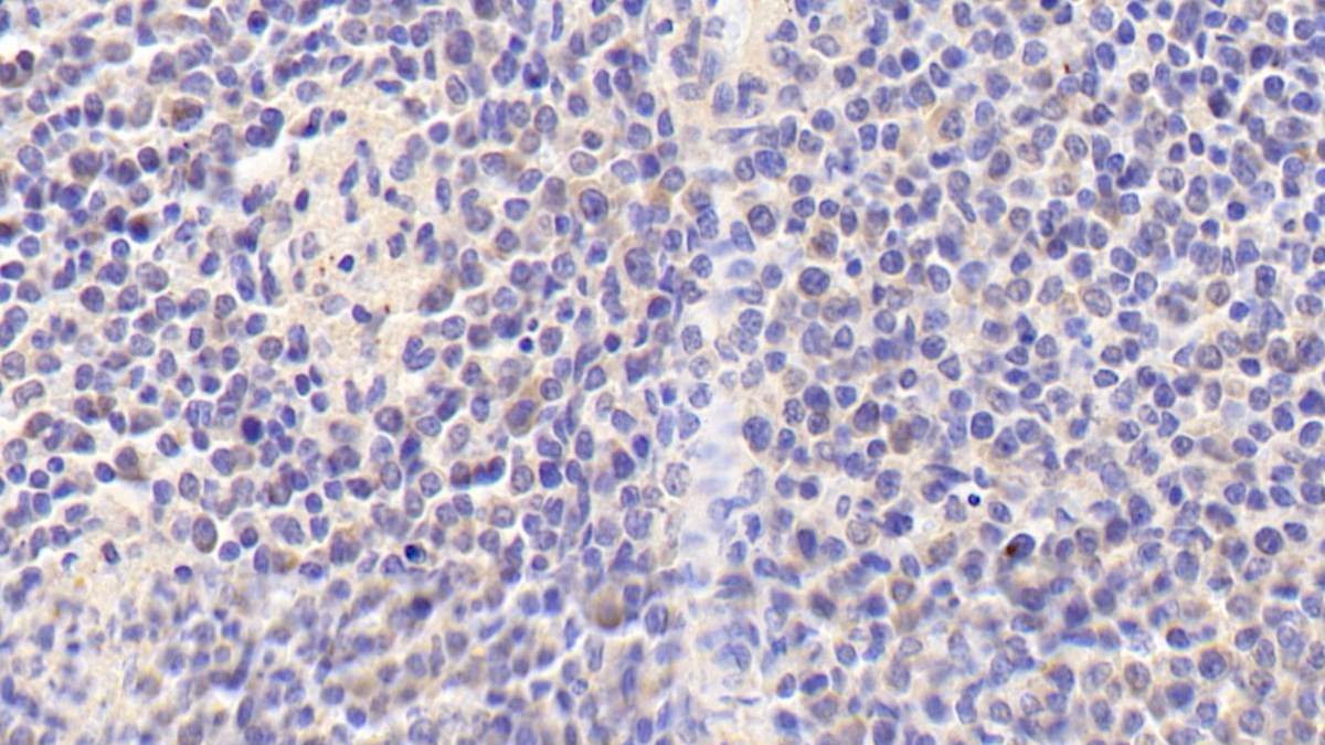 Polyclonal Antibody to Tumor Necrosis Factor Ligand Superfamily, Member 13 (TNFSF13)