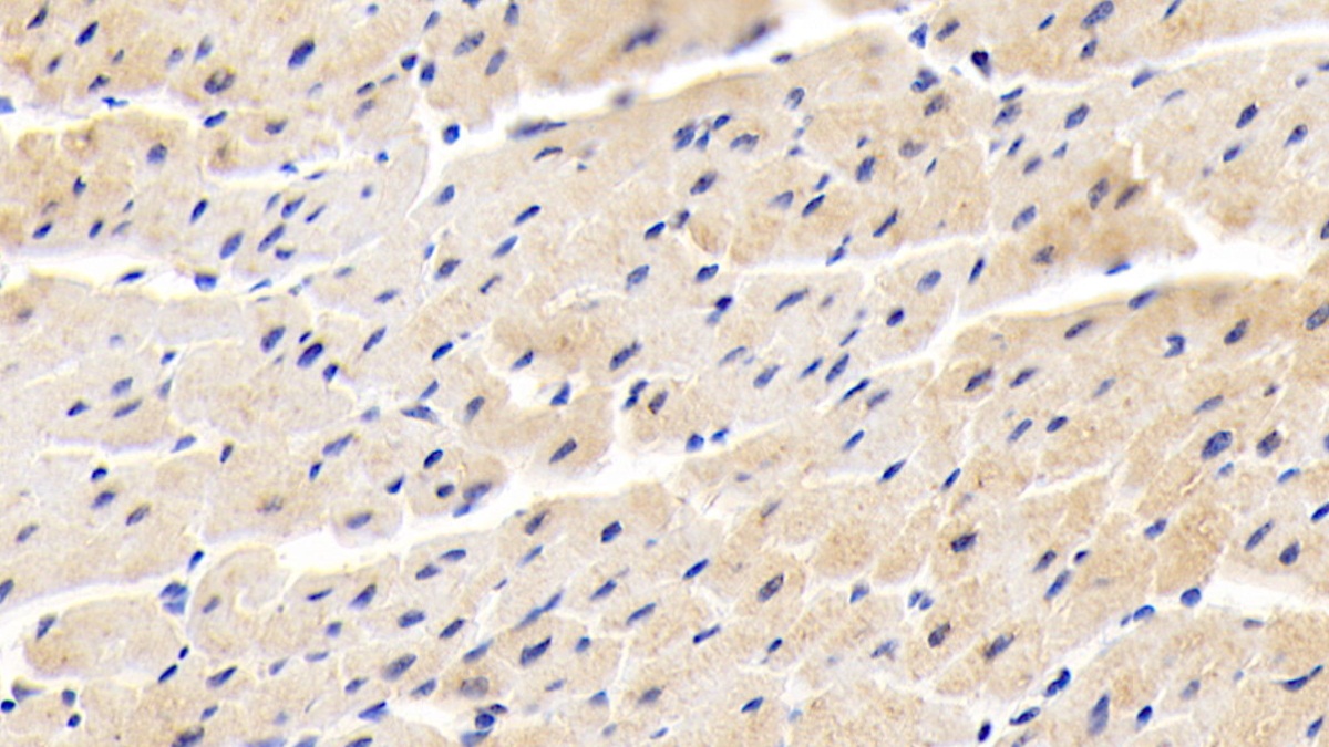 Polyclonal Antibody to Tumor Necrosis Factor Ligand Superfamily, Member 13 (TNFSF13)