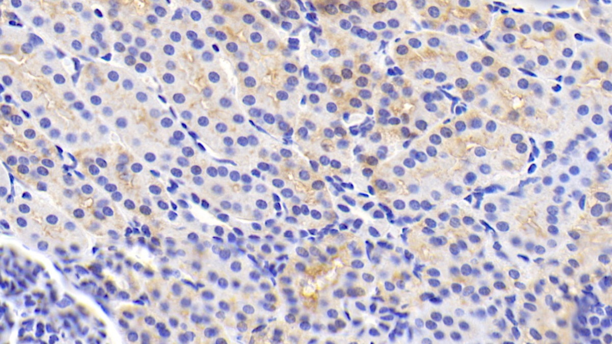 Polyclonal Antibody to Tumor Necrosis Factor Ligand Superfamily, Member 13 (TNFSF13)