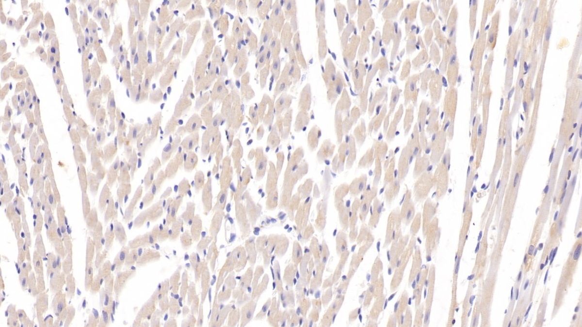 Polyclonal Antibody to Tumor Necrosis Factor Ligand Superfamily, Member 13 (TNFSF13)