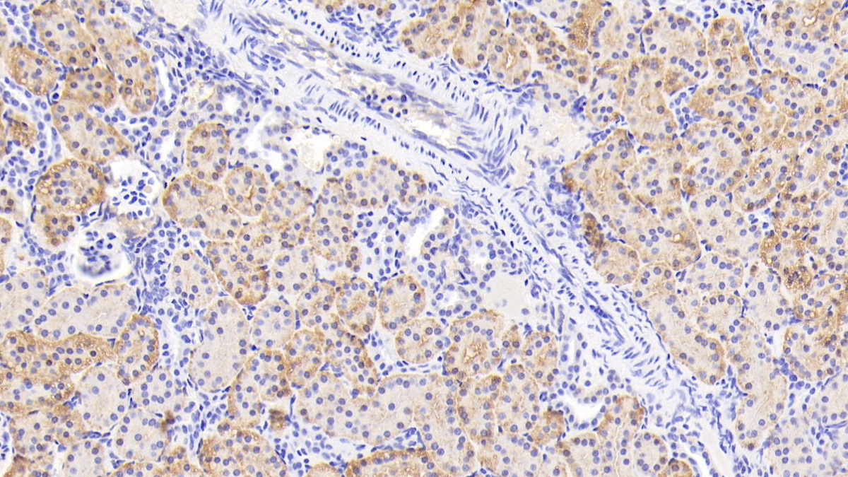 Polyclonal Antibody to Tumor Necrosis Factor Ligand Superfamily, Member 13 (TNFSF13)