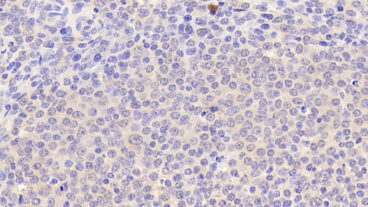 Polyclonal Antibody to Tumor Necrosis Factor Ligand Superfamily, Member 13 (TNFSF13)